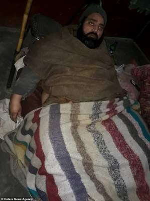 Пакистанец умоляет врачей отрезать ему ногу весом 150 кг