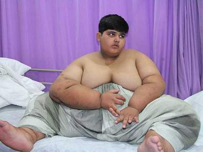 В Пакистане нашли "нового" самого толстого ребенка в мире