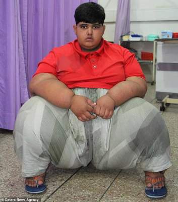 В Пакистане нашли "нового" самого толстого ребенка в мире